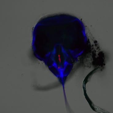 Blue Autofluorescence Channel Reveals Red Virus in Foregut